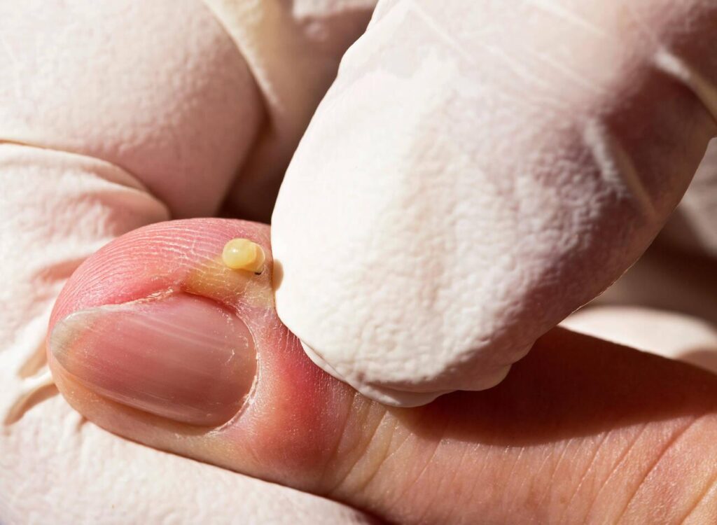 The Science of 35 Ancient Medical Practices Still In Use Today