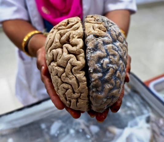 The Human Brain Explained So A 5 Year Old Could Understand