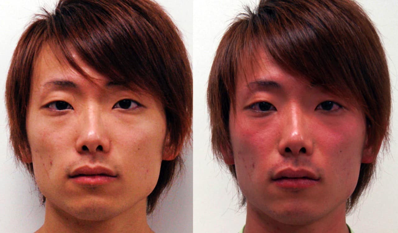 Some People Are Growing an Extra Artery &#8211; What that Means for Human Evolution