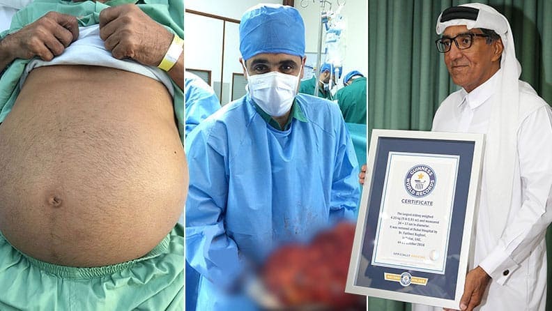 21 Human Body World Records That Are Hard to Handle