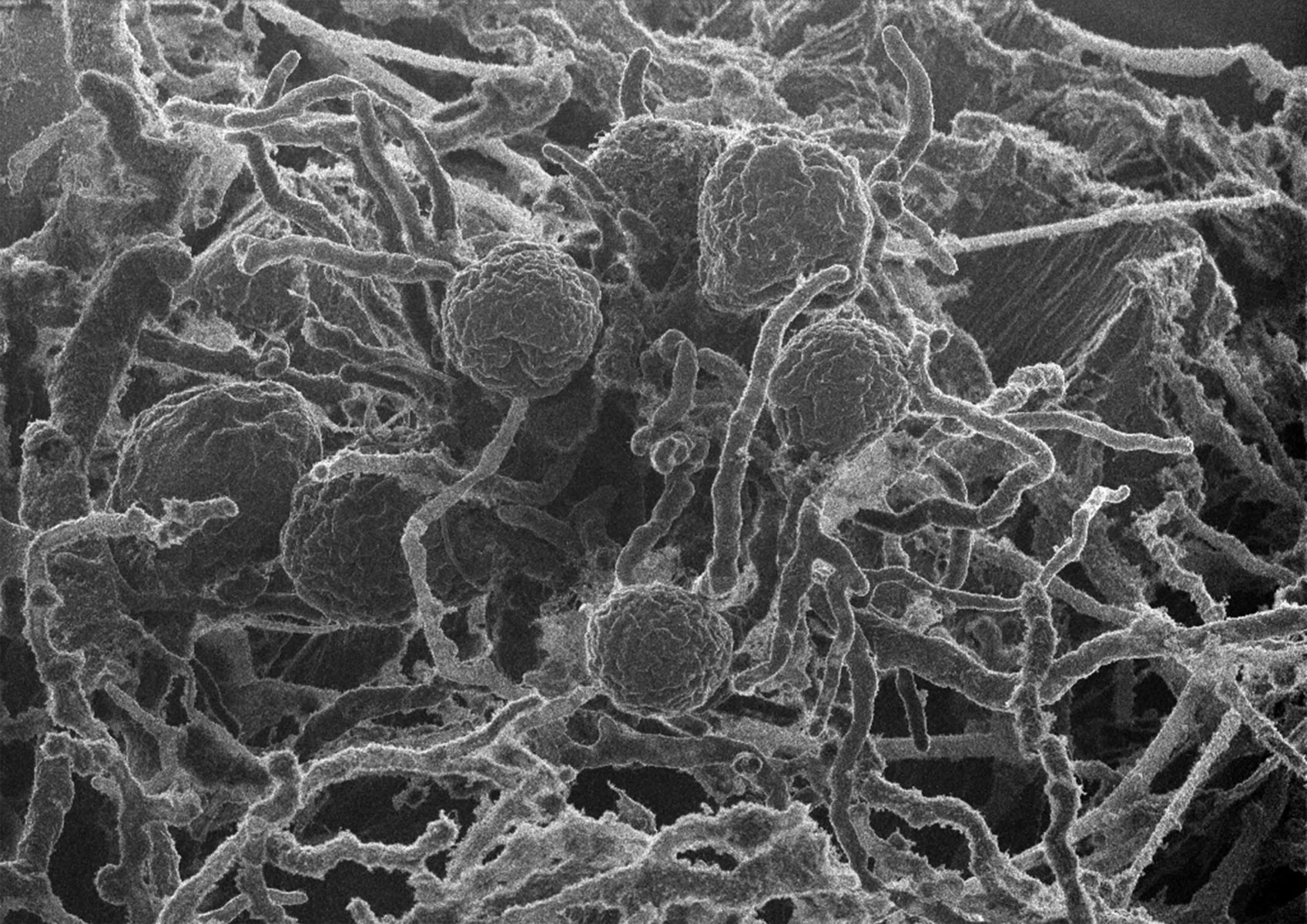 Energy Breakthroughs No One Is Talking About