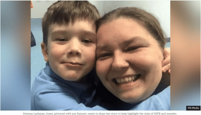 35 Verified Facts About the 2025 Measles Crisis: Debunking Misinformation