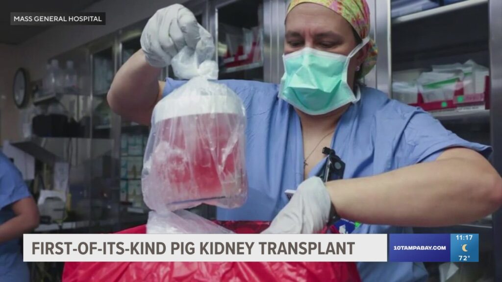 The Organ Crisis Is Over &#8211; Thanks to These 25 Genetic Transformations in Pigs