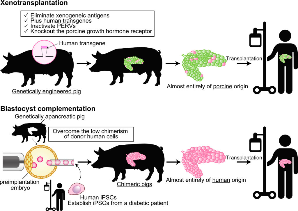 The Organ Crisis Is Over &#8211; Thanks to These 25 Genetic Transformations in Pigs
