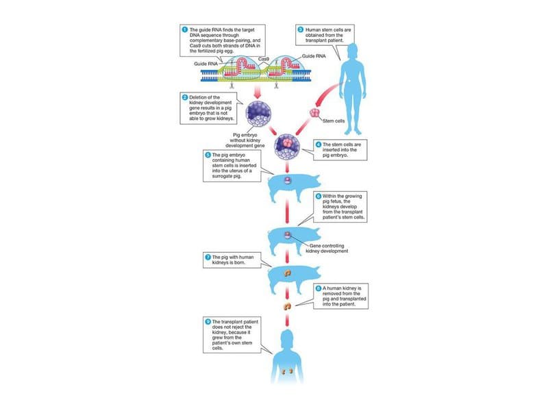 The Organ Crisis Is Over &#8211; Thanks to These 25 Genetic Transformations in Pigs
