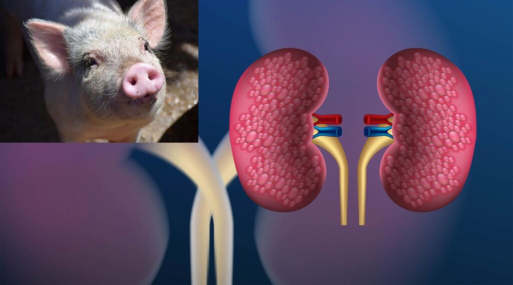 The Organ Crisis Is Over &#8211; Thanks to These 25 Genetic Transformations in Pigs