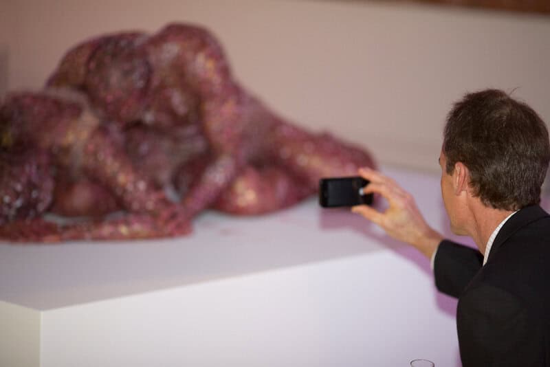 I have Alzheimer’s — I’m beating back the deadly disease with these simple lifestyle changes