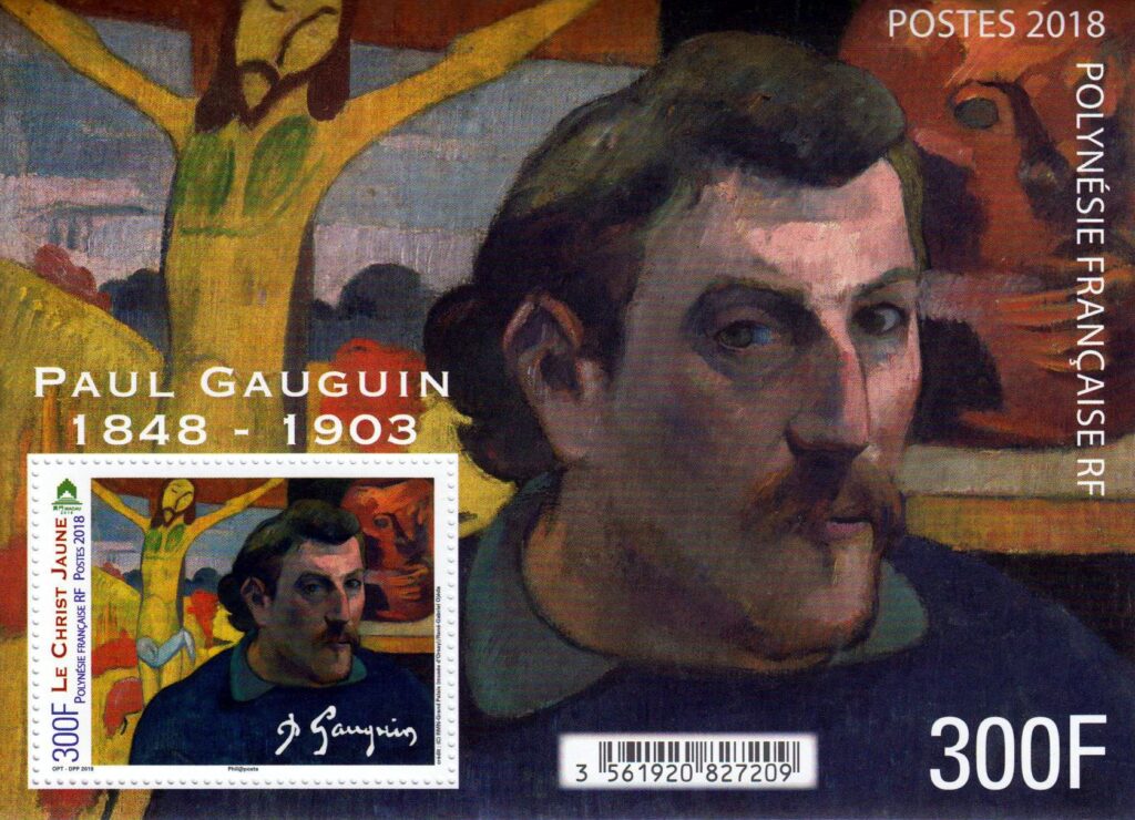 Struck By Luck: 39 People Who Accidentally Gained Superpowers After An Injury