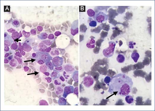 Gene Therapy Will Cure the Incurable: 30 Genetic Diseases with Expiration Dates