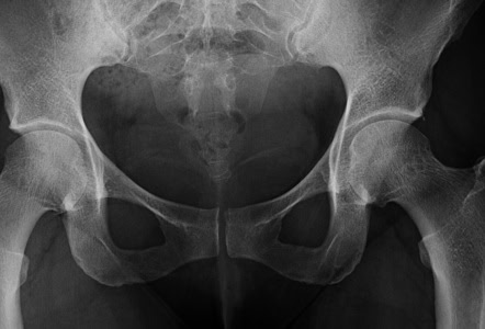 Evolution&#8217;s Biggest Mistakes: 24 Body Parts That Prove We&#8217;re Still Works in Progress