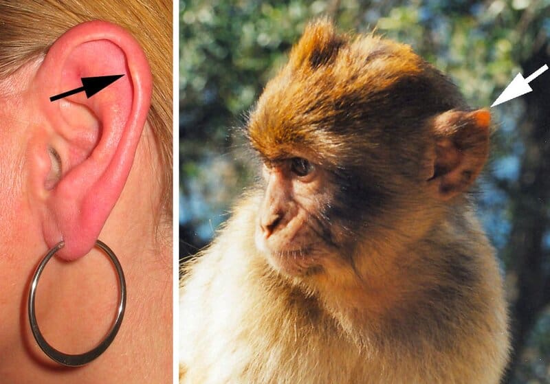 Evolution&#8217;s Biggest Mistakes: 24 Body Parts That Prove We&#8217;re Still Works in Progress