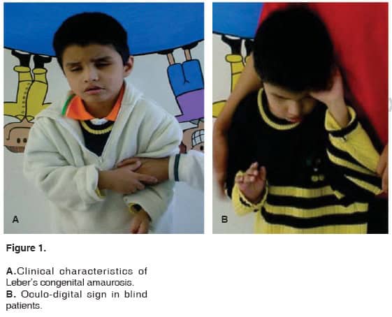 Gene Therapy Will Cure the Incurable: 30 Genetic Diseases with Expiration Dates