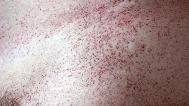 Gene Therapy Will Cure the Incurable: 30 Genetic Diseases with Expiration Dates