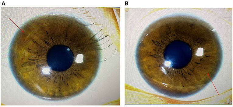 Gene Therapy Will Cure the Incurable: 30 Genetic Diseases with Expiration Dates