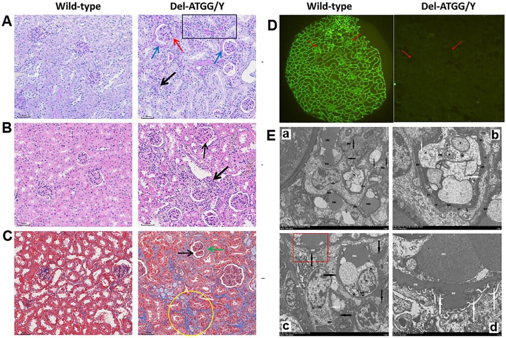 Gene Therapy Will Cure the Incurable: 30 Genetic Diseases with Expiration Dates