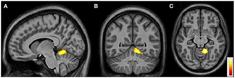 Gene Therapy Will Cure the Incurable: 30 Genetic Diseases with Expiration Dates