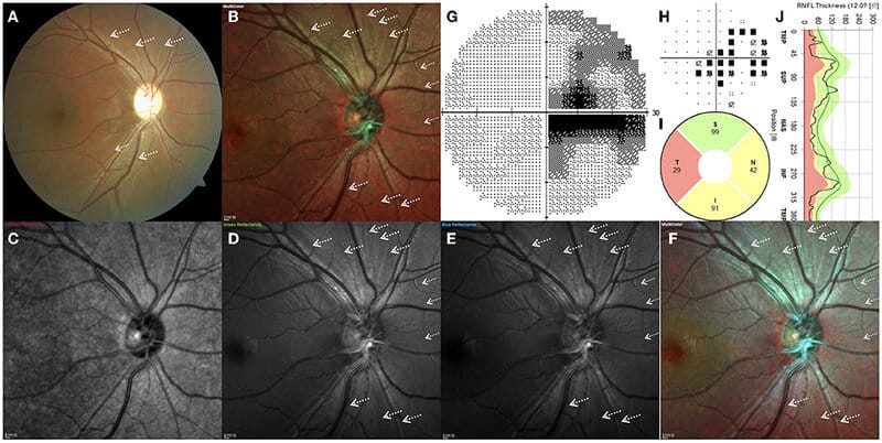 Gene Therapy Will Cure the Incurable: 30 Genetic Diseases with Expiration Dates