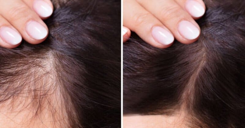 Life After Smoking — 28 Incredible Changes Your Body Will Thank You For