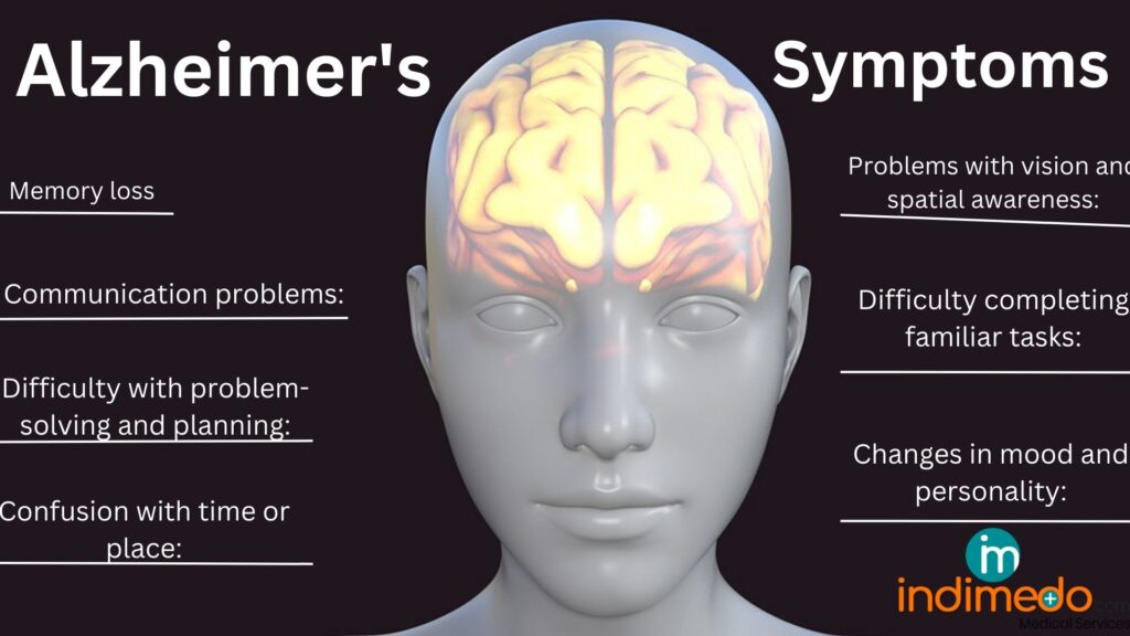 Signs of Alzheimer’s Could Appear Decades Before Diagnosis, Study Finds
