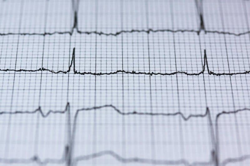 15 Heart Attack Warning Signs + 10 Ways to Protect Yourself That Doctors Swear By