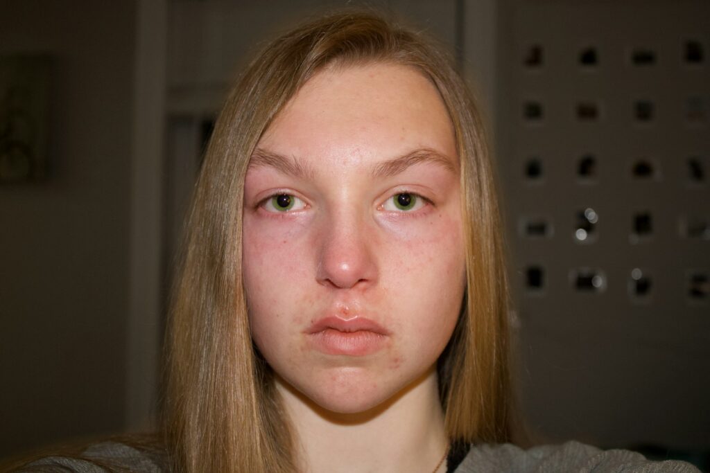 The symptoms you&#8217;re ignoring could kill you: An ER doctor&#8217;s list of 26 deadly warning signs