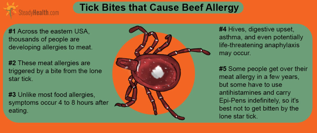 Shocking Discovery: Multiple Tick Species Can Trigger Deadly Red Meat Allergy — 25 Critical Facts That Could Save Your Life