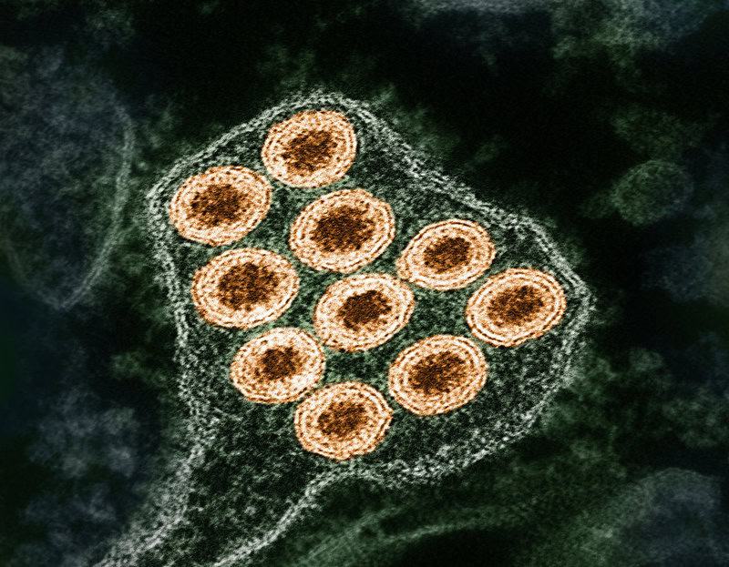 The Zombie Makers: Meet the Parasites That Control Animal Minds