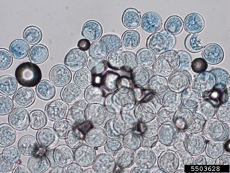 The Microscopic Vampire That Could Cure Candida Infections