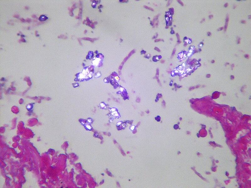 The Climate Solution Hiding in Plain Sight: Trees That Eat CO2 and Poop Out Rocks