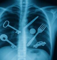Top 15 Weirdest Things Scientists Have Ever Found Inside the Human Body