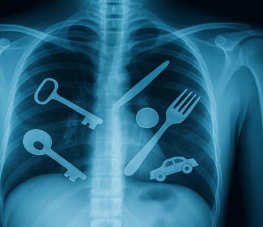 Top 15 Weirdest Things Scientists Have Ever Found Inside the Human Body