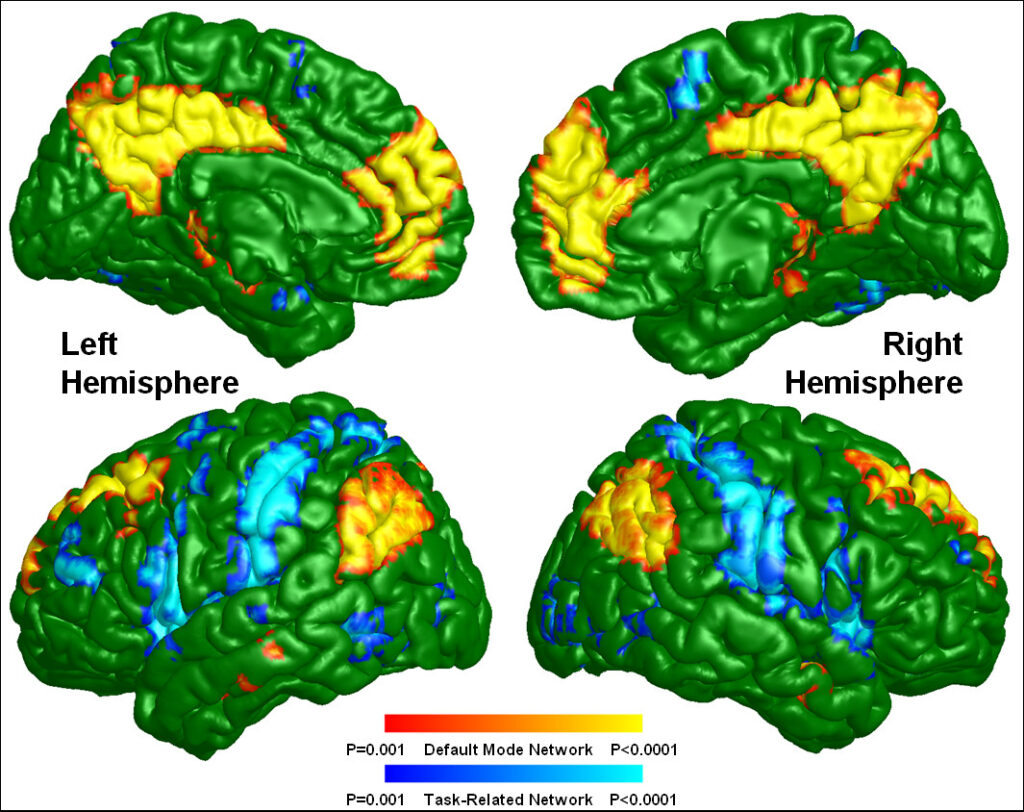 The Free Will Illusion How Your - Default Mode And Task Related Maps For Healthy Subjects 1024x812 