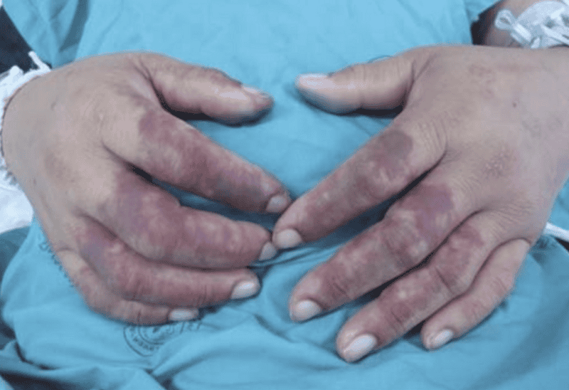 Scientists Finally Found the Psychedelic Source of LSD