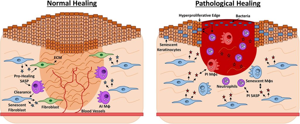 This One Vitamin Became the Secret Weapon in Wound Healing &#8211; Breakthrough Discovery
