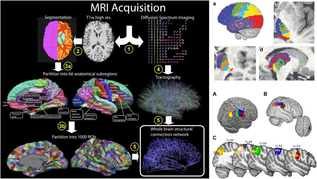 Scientists Map 140,000 Neurons in Fruit Fly Brain &#8211; Here&#8217;s What It Reveals About Human Memory