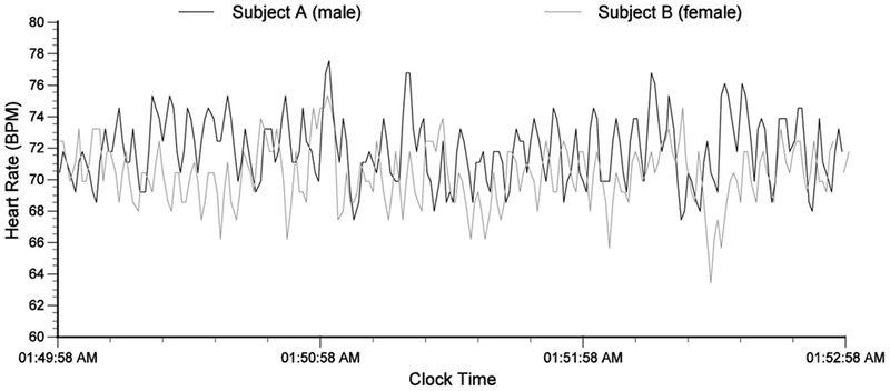 Scientists Discovered a &#8220;Second Brain&#8221; in Your Heart—And It Remembers Everything