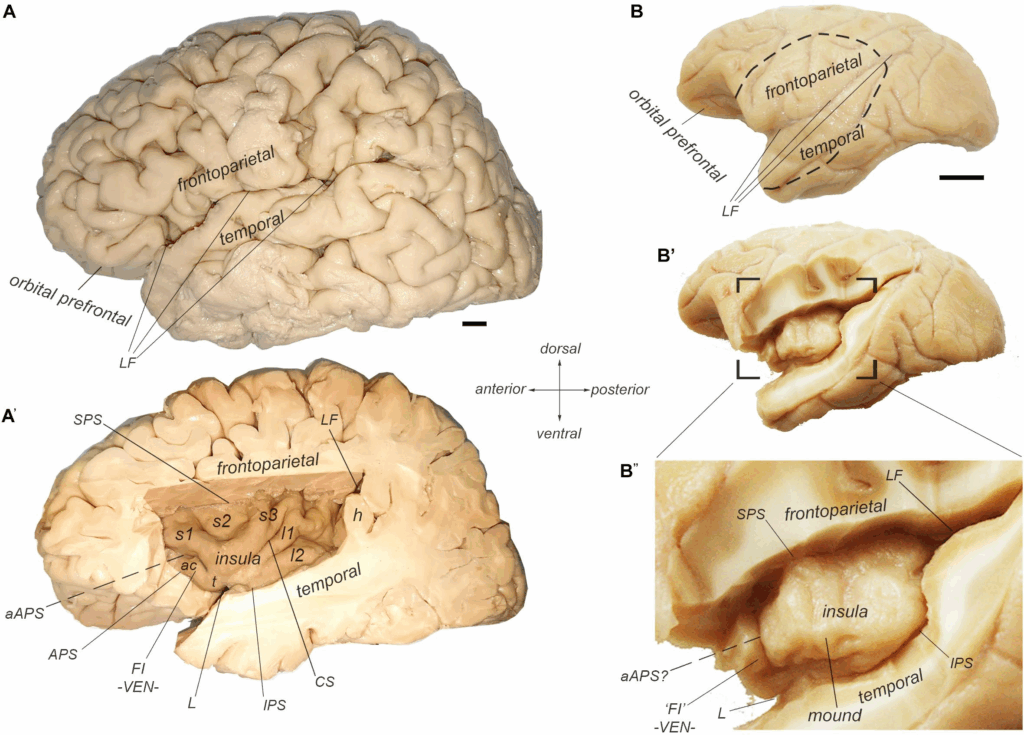 The Free Will Illusion: How Your Brain Tricks You Into Thinking You&#8217;re Making Choices