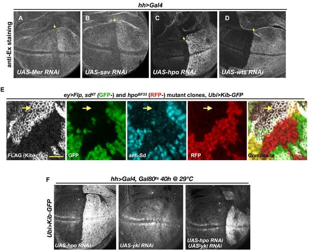 The Protein That Lets Memories Last Forever &#8211; KIBRA&#8217;s Role in Long-Term Memory
