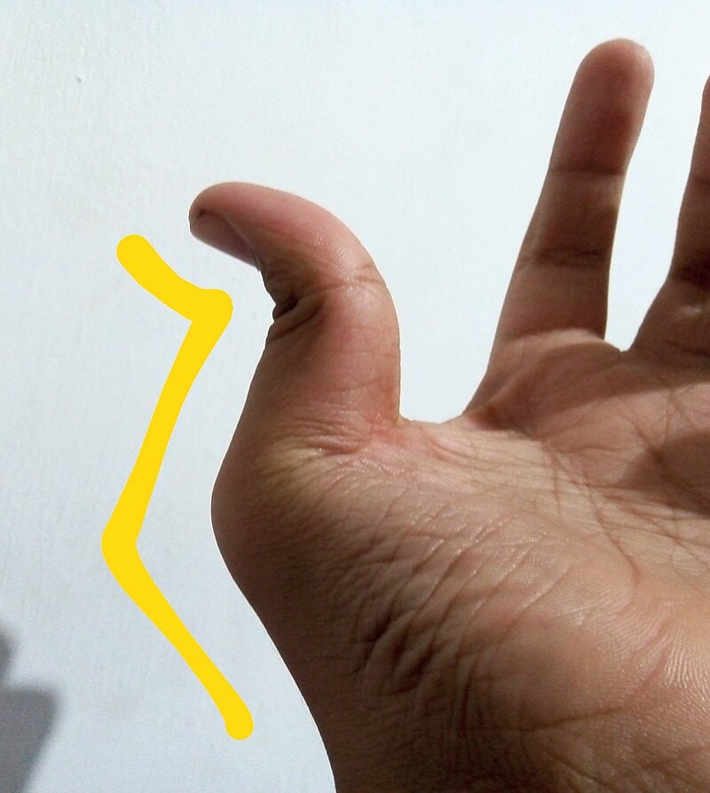 15 Mind-Blowing Genetic Traits You Didn’t Know You Inherited