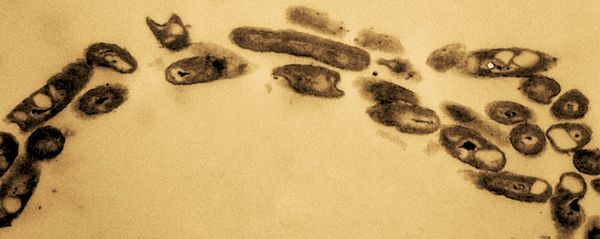 12 Bizarre Micro-Organisms Found Thriving in Plastic Waste