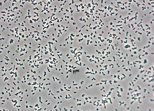 12 Bizarre Micro-Organisms Found Thriving in Plastic Waste