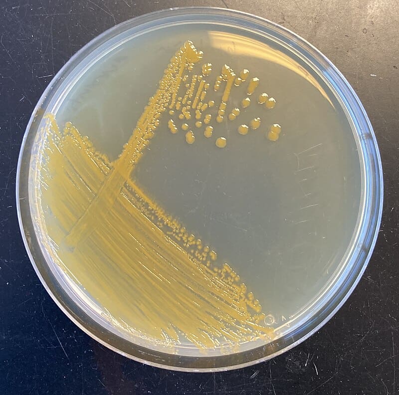 12 Bizarre Micro-Organisms Found Thriving in Plastic Waste