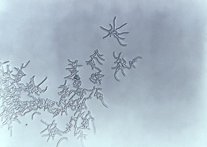 12 Bizarre Micro-Organisms Found Thriving in Plastic Waste