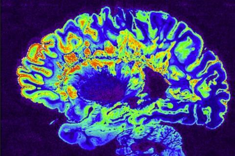 12 Ancient Viruses Still Living Inside Your DNA