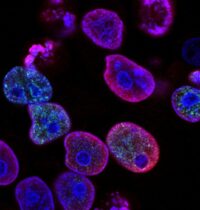 8 Ovarian Cancer Targets Scientists Are Now Unlocking