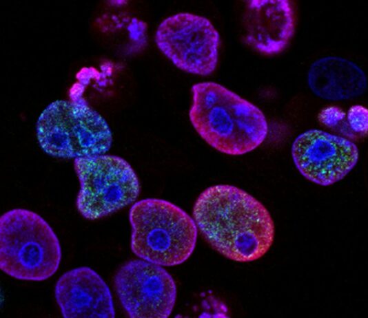 8 Ovarian Cancer Targets Scientists Are Now Unlocking