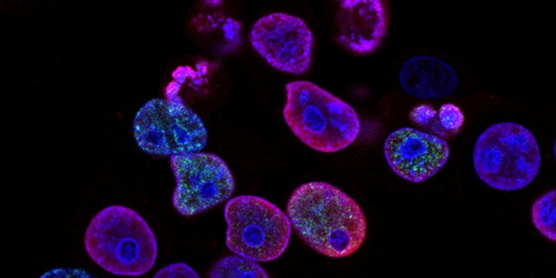8 Ovarian Cancer Targets Scientists Are Now Unlocking