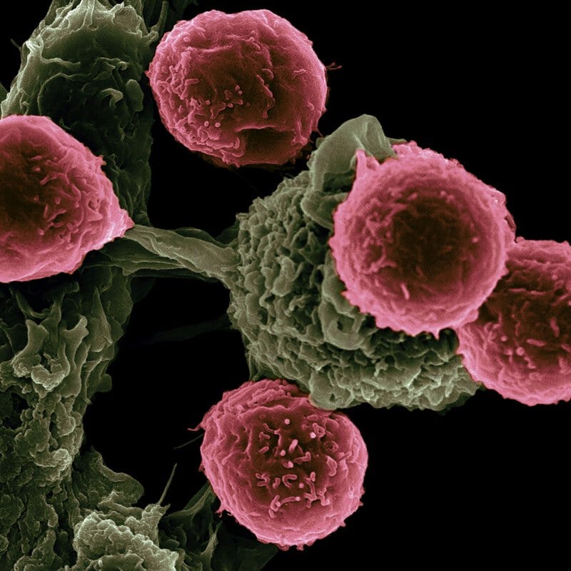8 Ovarian Cancer Targets Scientists Are Now Unlocking