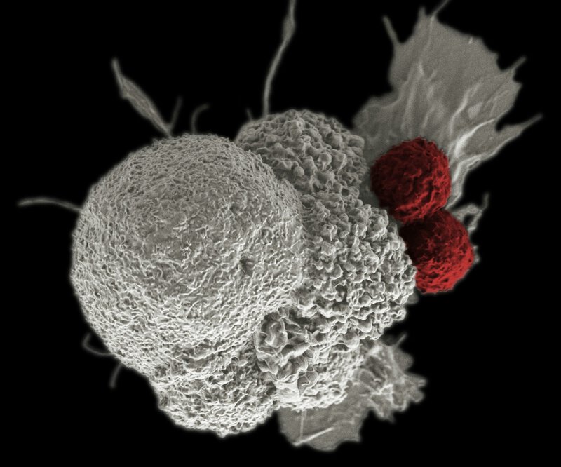 8 Ovarian Cancer Targets Scientists Are Now Unlocking