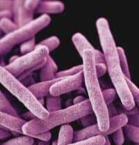 Tuberculosis Can Spread Before Symptoms Appear, Study Warns